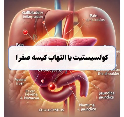 التهاب کیسه صفرا